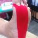 Guest Blog: Management of Plantar Fasciitis Pain with Kinesiology Tape- A Case Report